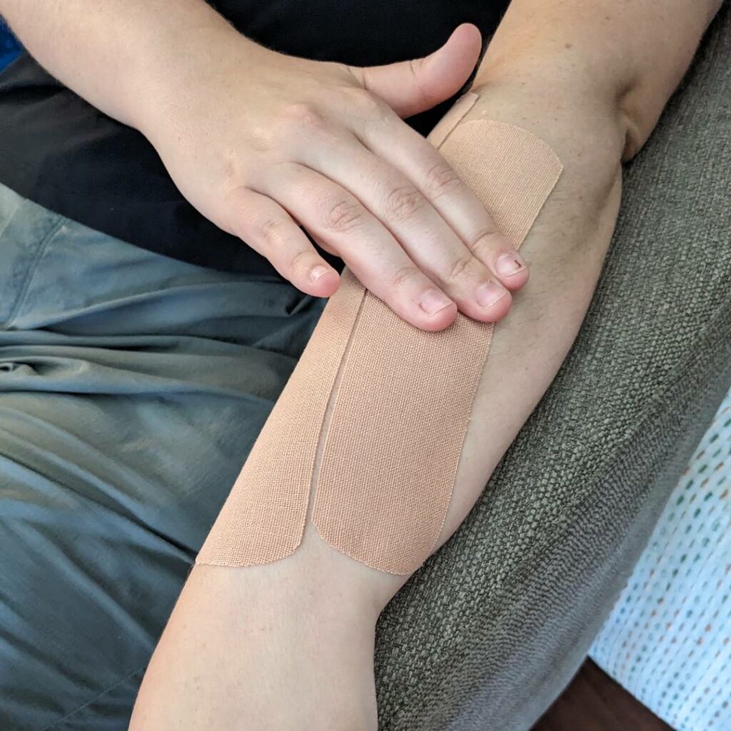 Kinesiology tape can relax tight muscles. Shown here, relaxed forearm muscles can relieve pain in the wrist, fingers, and thumb.
